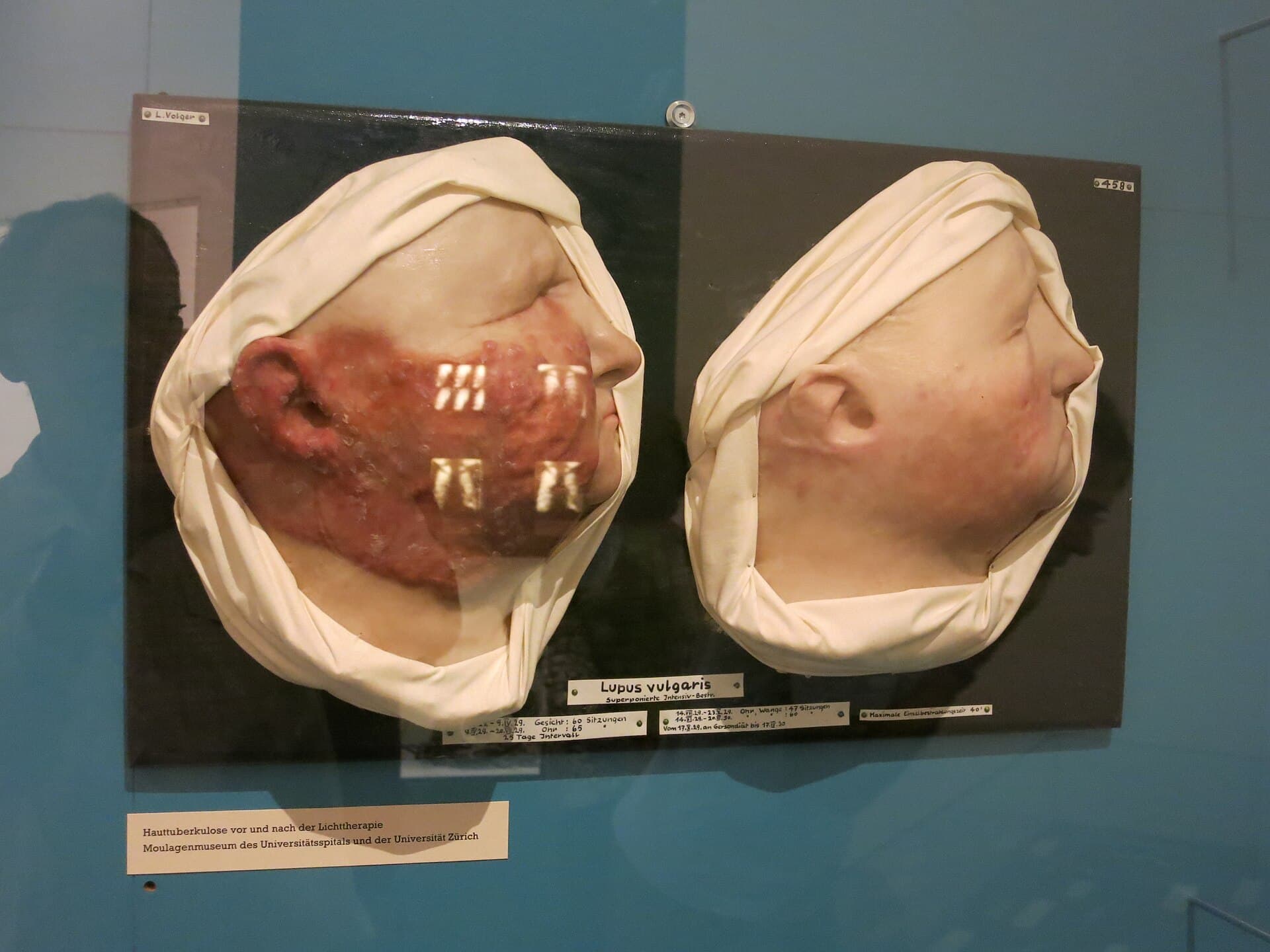 Moulage Museum, Zurich